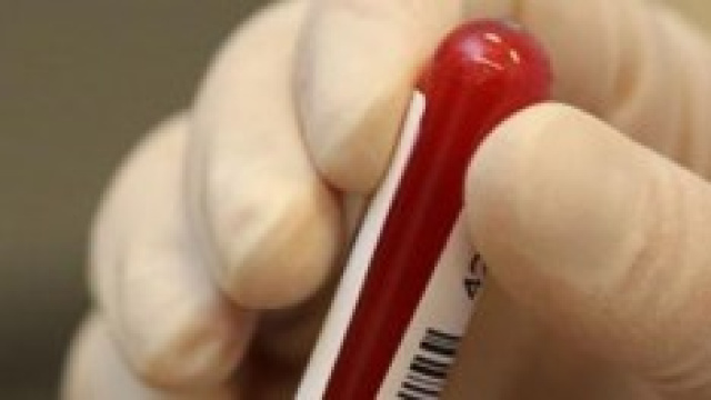 I nuovissimi controlli contro il doping