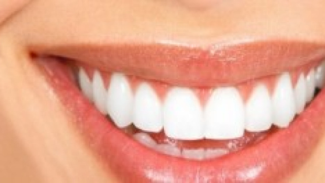 Un sorriso perfetto con denti perfetti