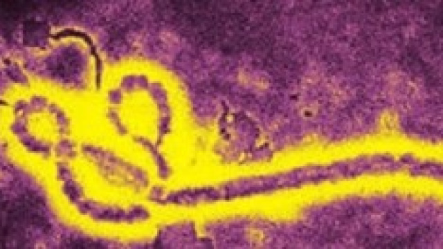 Il virus Ebola al microscopio