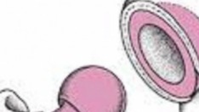 Protesi d'anca, femore e acetabolo