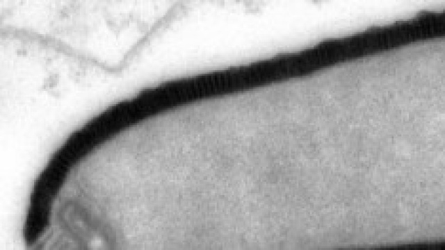 Virus Phitovirus Siberia 