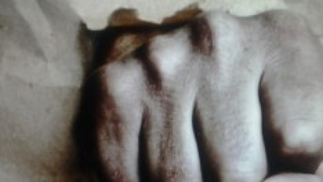 Prima vittima in Italia del knockout game