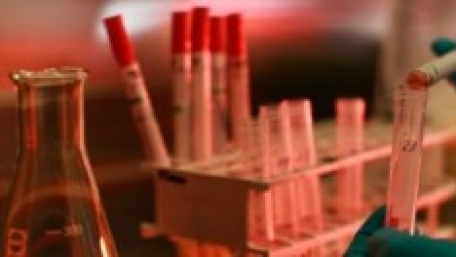 Ebola, Ministero della Salute: 'Nessun allarme'