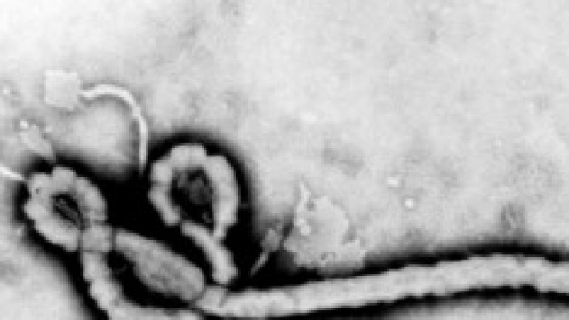 Rappresentazione grafica del virus Ebola