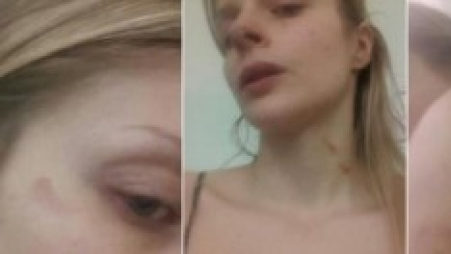 Francesca Cipriani brutalmente picchiata