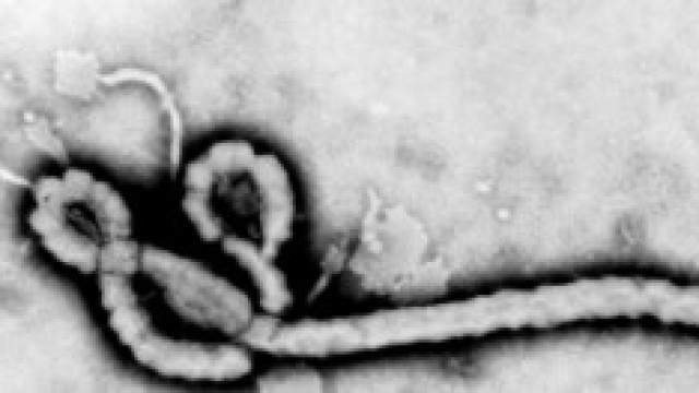 Il virus Ebola al microscopio