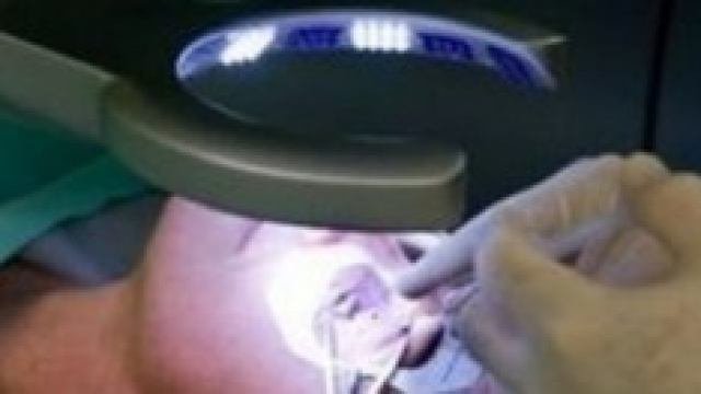 Operazione con laser ad eccimeri, &egrave; necessaria?