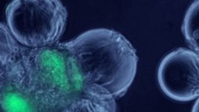 Come &egrave; composto il virus dell'AIDS?