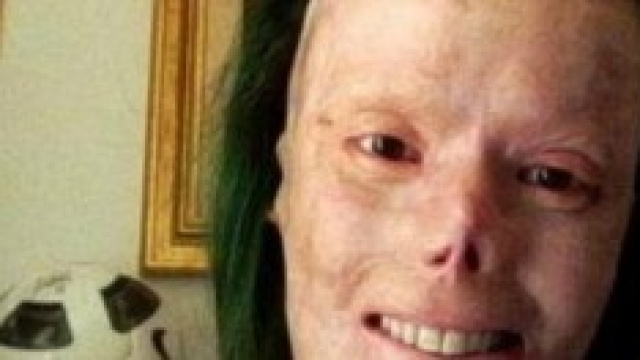 Valentina Pitzalis, che non ha perso il sorriso