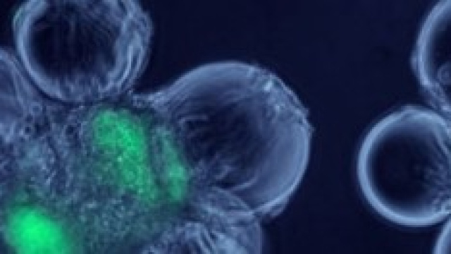 Nella foto, cellule staminali al microscopio.