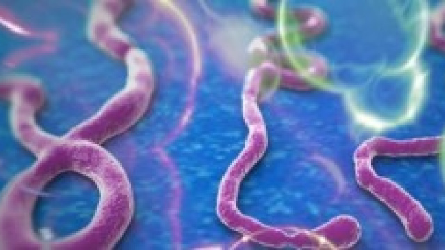 Ebola al microscopio elettronico.
