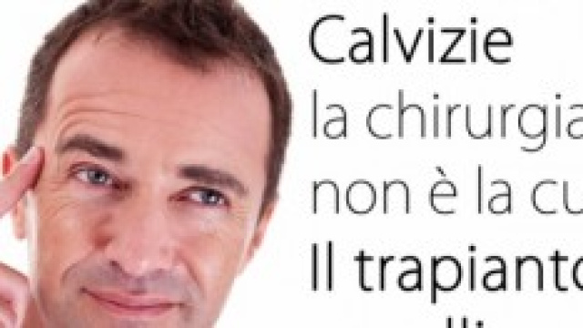 Il Trapianto di Capelli non &egrave; la cura