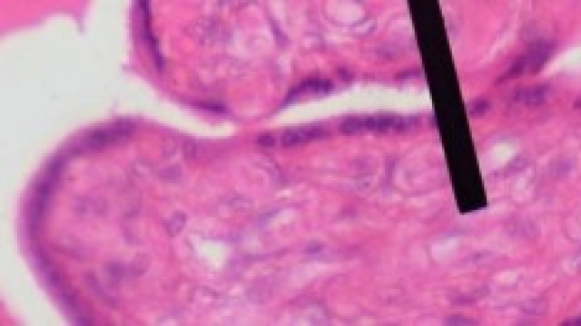 Cellule staminali usate contro le malattie.