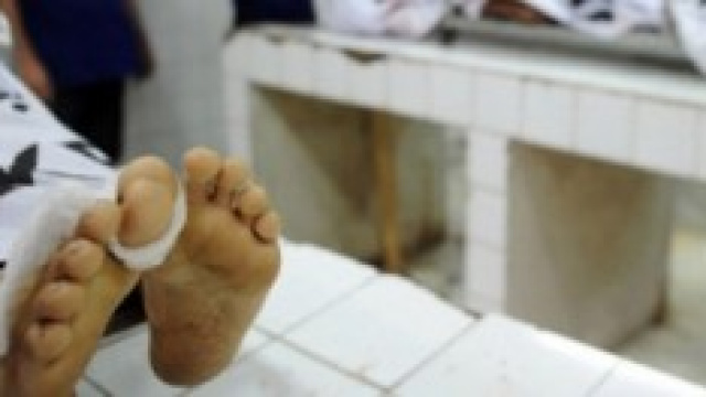 cadavere di un uomo in un obitorio