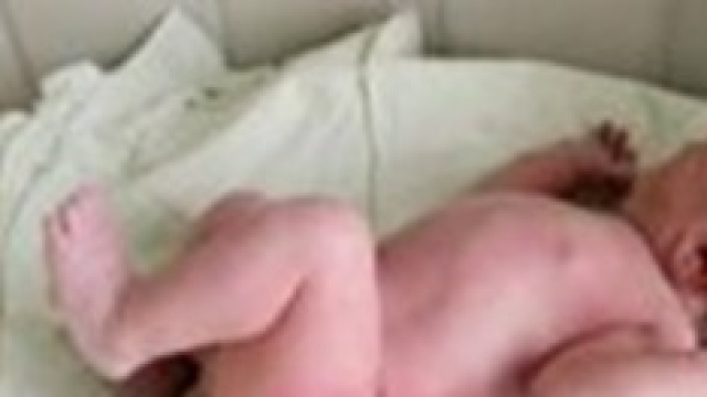 Uno dei due gemelli nati a 24 giorni di distanza