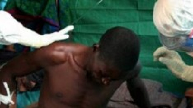 Intervento su malato ebola Medici senza frontiere.
