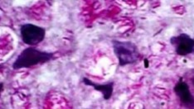Il batterio Mycobacterium leprae