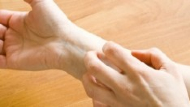 Allergia al nichel: una pillola per curarla