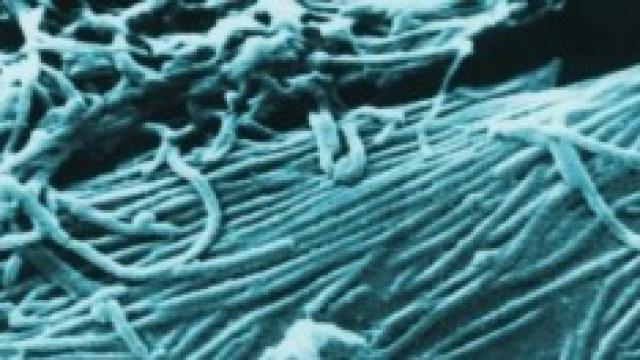 Virus Ebola: quello che c'&egrave; da sapere