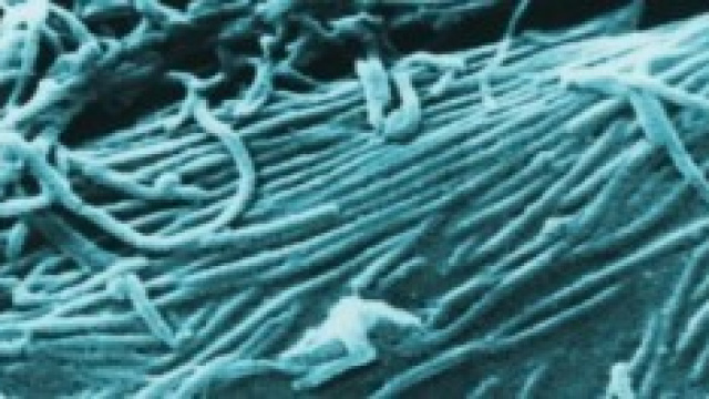 virus Ebola: guariti operatori sanitari 