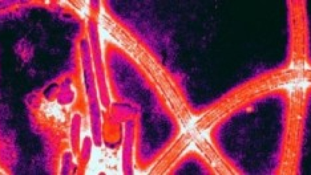 particolare del virus ebola