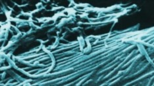 Scongiurato il pericolo ebola 