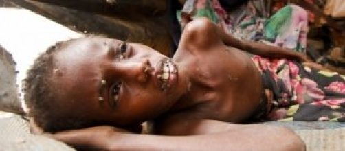 A nadie le debiera faltar agua y alimento