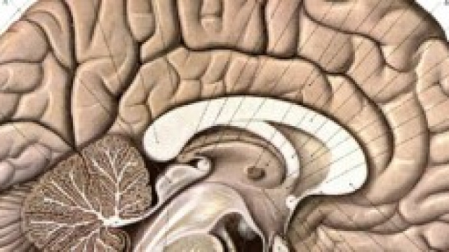 Donna di 24anni scopre di non avere il cervelletto