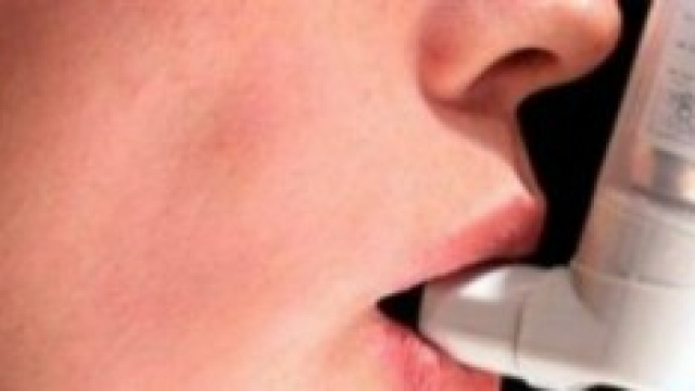 Donna cura l'asma bronchiale