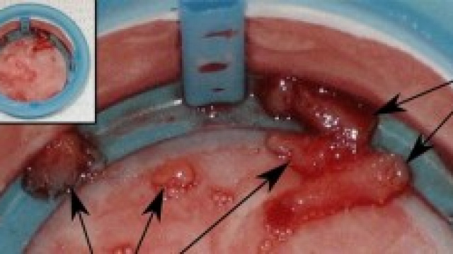 Colesterolo alto: ecco 10 alimenti per abbassarlo