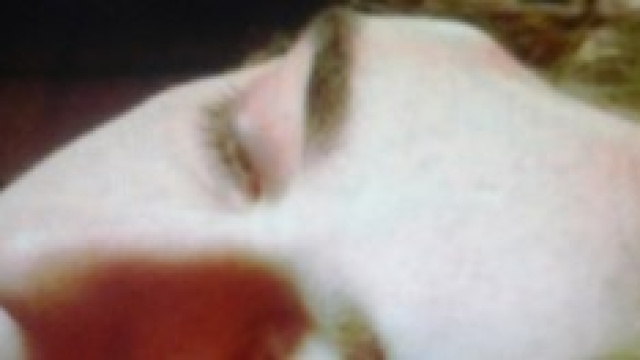 Connor Huntley dopo l'aggressione