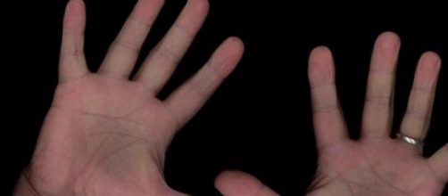 Cient&iacute;ficos argentinos pueden frenar el Parkinson