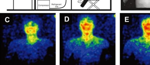 Emisi&oacute;n de biofotones por el cuerpo humano