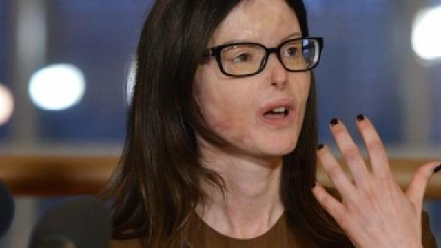 L'avvocattessa Lucia Annibali