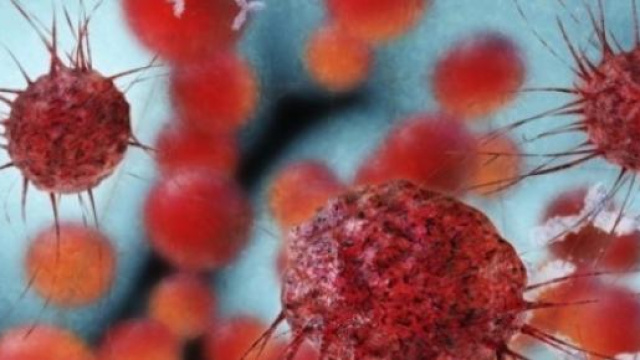 L'immagine al microscopio di una cellula tumorale