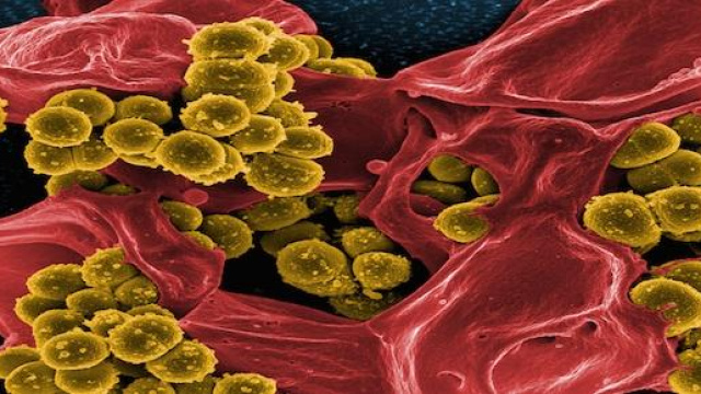 Nella foto: Methicillin Staphylococcus (MRSA)