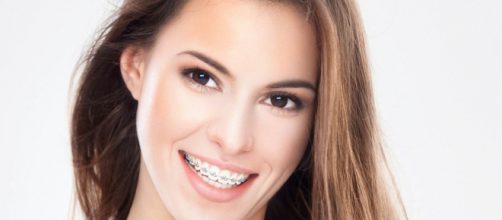 Beautyful girl wearing braces is sexy