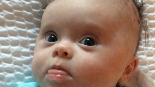 La piccola Abigail Jones di due mesi