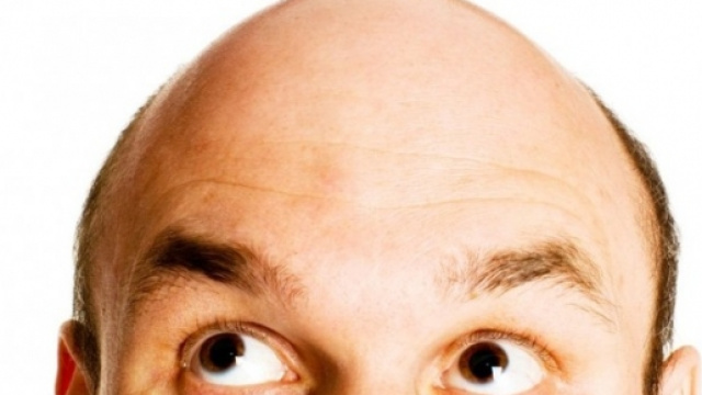 Un uomo calvo che guarda in alto