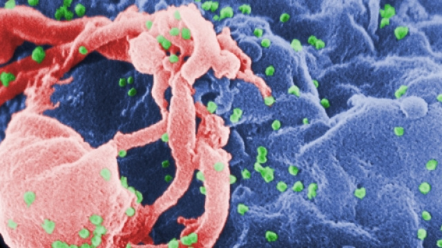 'Foto Wikipedia'. Microscopica immagine dell'HIV
