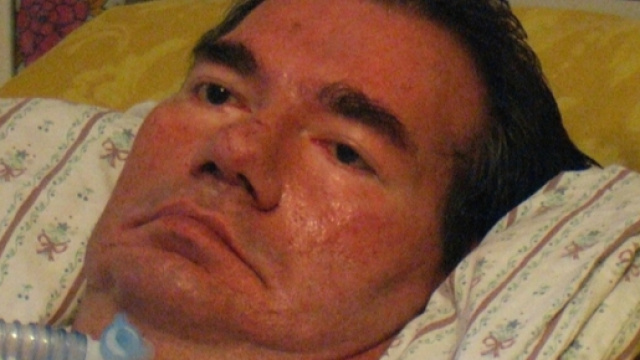 Piergiorgio Welby: stadio finale della malattia.