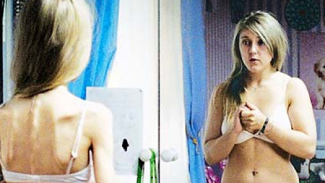 Lo sguardo dell'anoressia: un corpo dismorfico