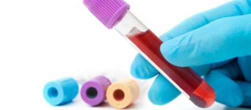 An&aacute;lisis de sangre para detectar tumores