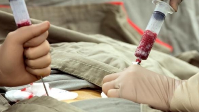 Trapianto di midollo osseo in sala operatoria