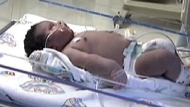 Bambino da 9,8 chili Calabria, foto di ansapress