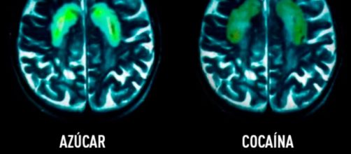 Efectos en el cerebro del az&uacute;car y la coca&iacute;na