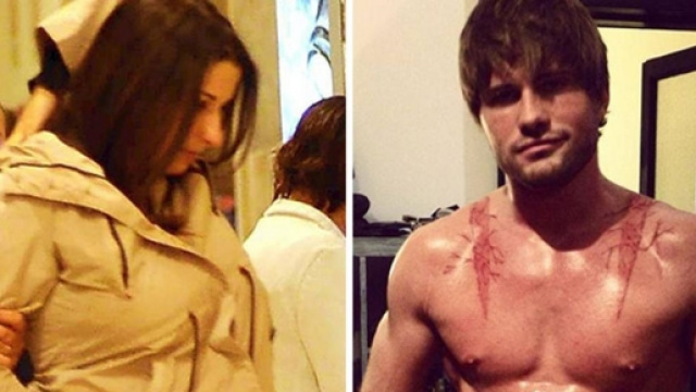 Martina e Alex, la coppia dell'acido