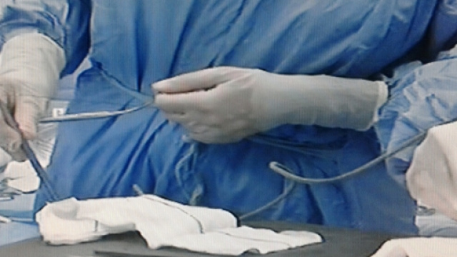 Intervento chirurgico di trapianto di organi