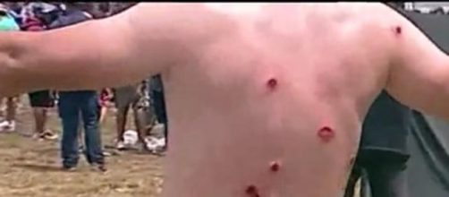 Los gendarmes se sobrepasaron con brutal represi&oacute;n