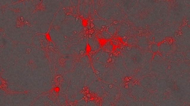 neuroni gabaergici (http://www.gaba-autism.com)